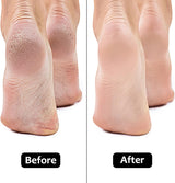 PedicurePro® - Smooth, Healthier Feet in minutes